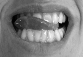 Photo_Auto_Massage_Dents_Saliver